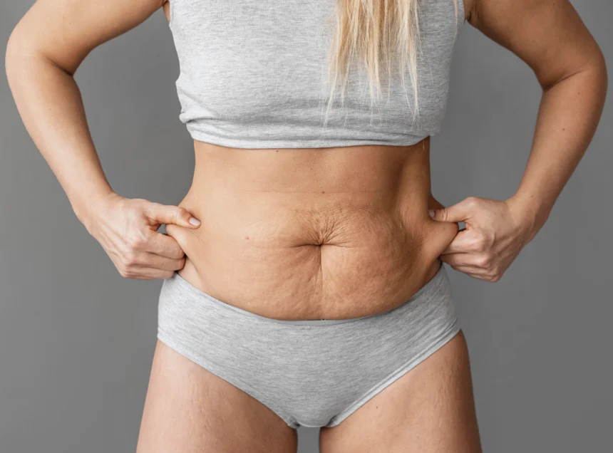 Restoring Breast Contour After Pregnancy and Weight Loss